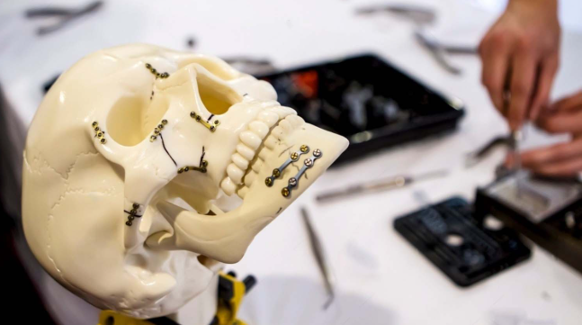 Understanding Cranio-Maxillofacial Implant Systems
